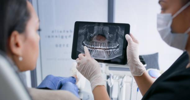 Licensed Tooth Extraction service in Morgan Hill, CA - Smile Center Dentistry